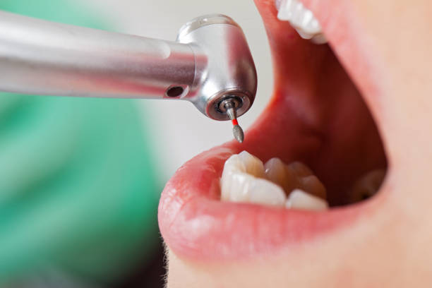 Best Emergency Dental Care for Broken or Chipped Teeth in Mohave Valley, AZ